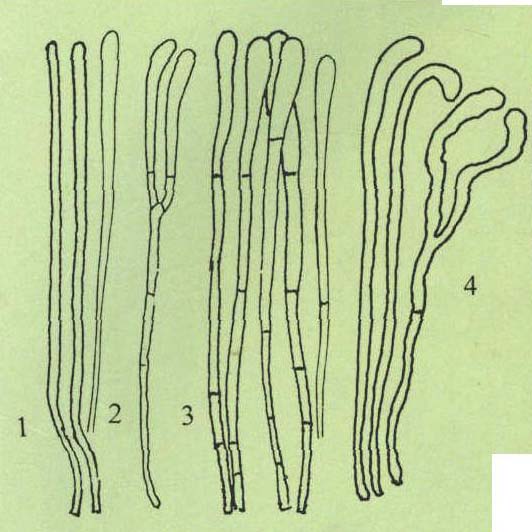 圖3 側絲形態(tài)