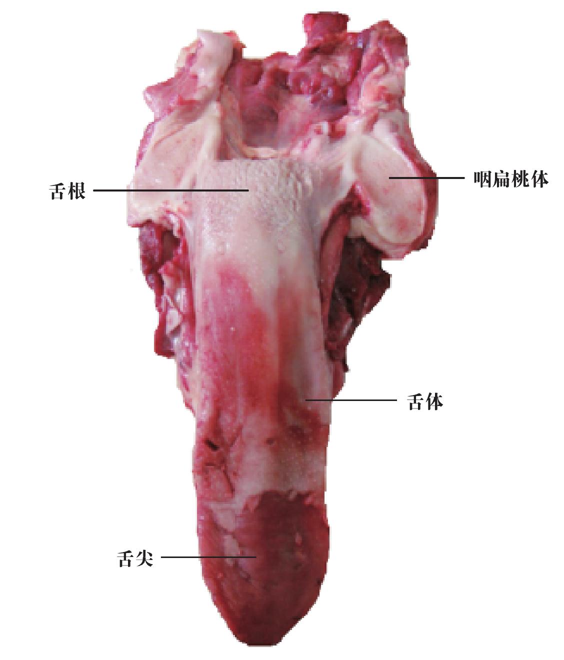 三、扁桃體